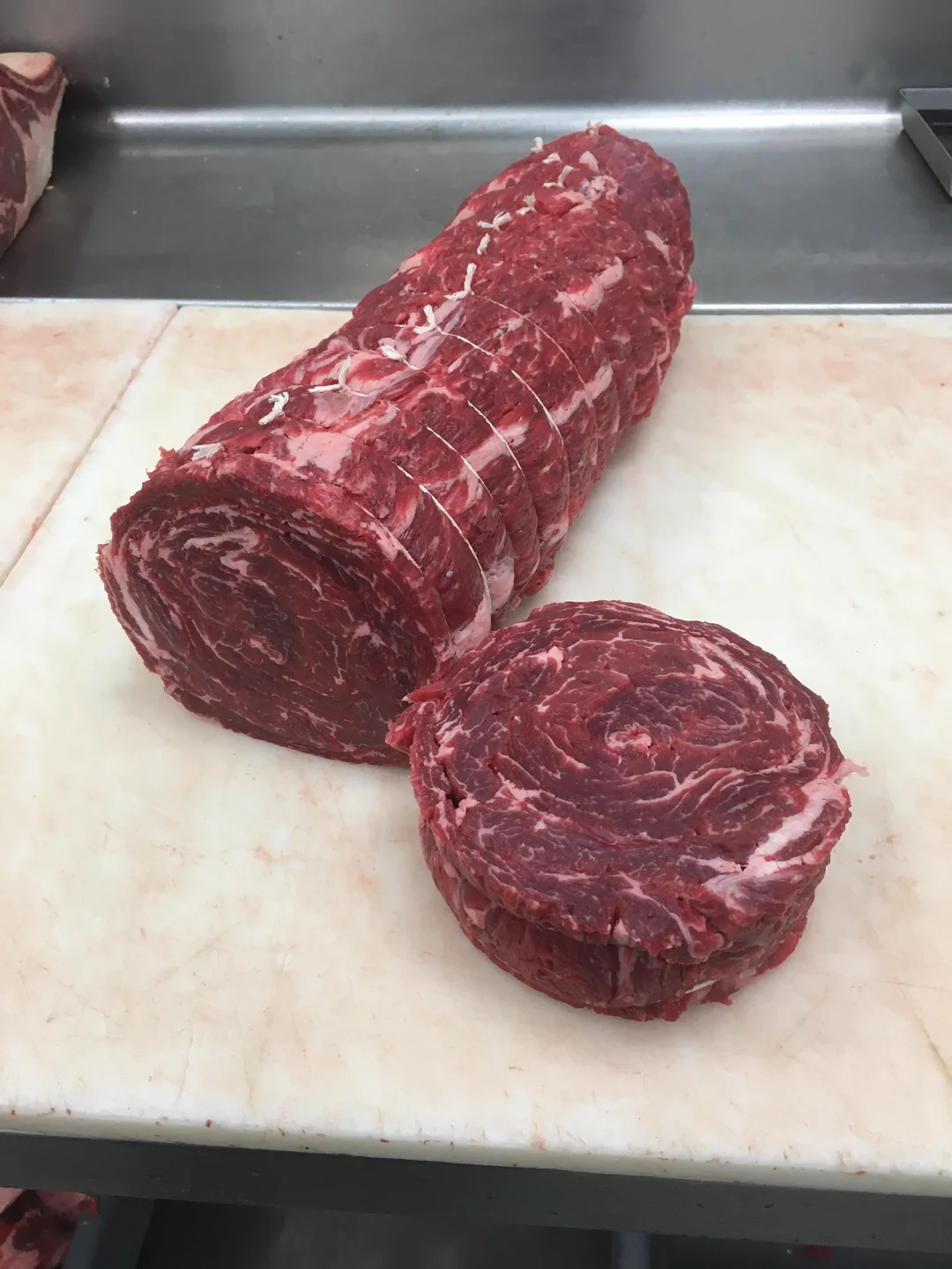 Whole Spinalis